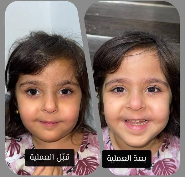الصورة 4 من 5
