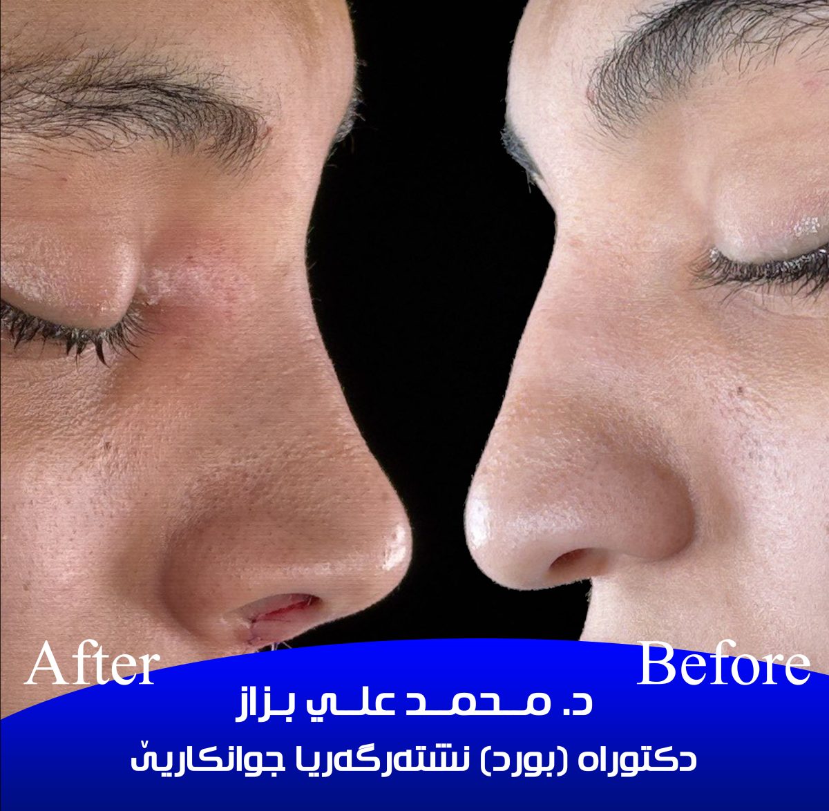 الصورة 2 من 4